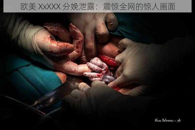 欧美 XxXXX 分娩泄露:震惊全网的惊人画面