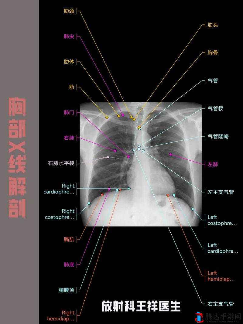 100%胸片曝光率 2023:全方位解读