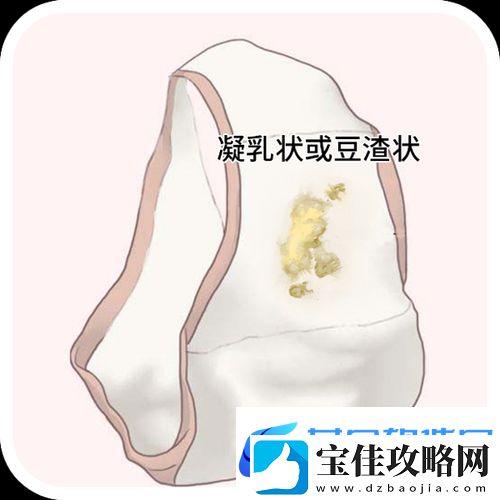 女生次数多了会有豆腐渣分泌物吗