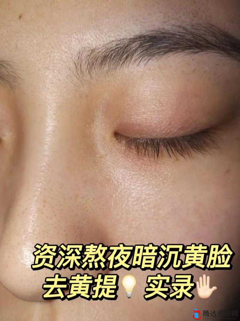 熬夜必备以黄去黄取消了进出限制:让你告别疲惫焕发光彩