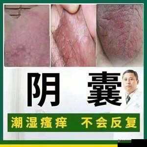 男生**痒是何缘由?探究其背后的秘密