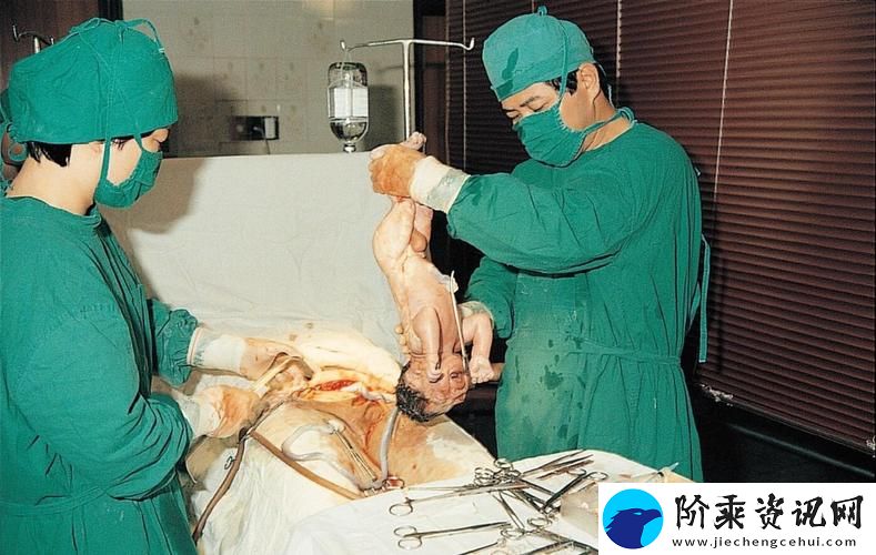 产妇生产不遮阴大全