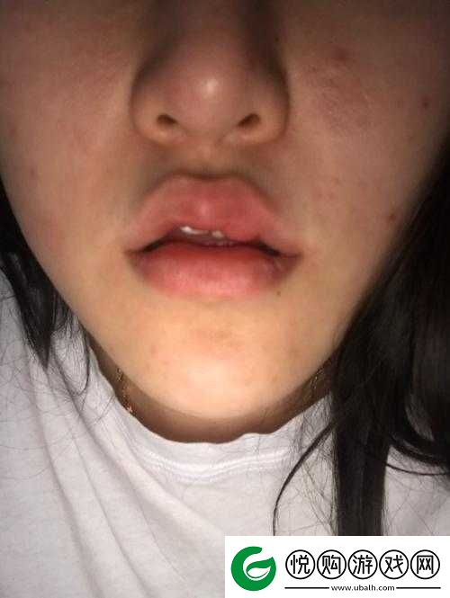 策划上下两张嘴都肿了