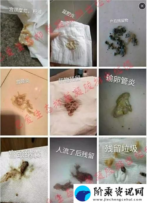 月月我这是帮你排阴毒的作者