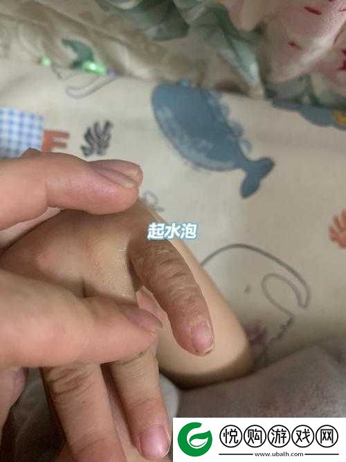 宝宝才两根手指竟就出现异常流液现象