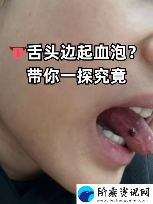 他的舌头探进蜜源毛毛虫说说