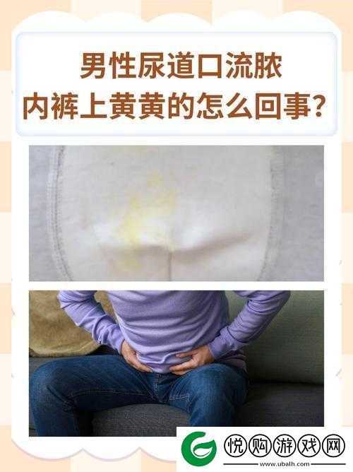 男性尿道口流脓内裤上黄黄的到底是怎么回事该如何应对