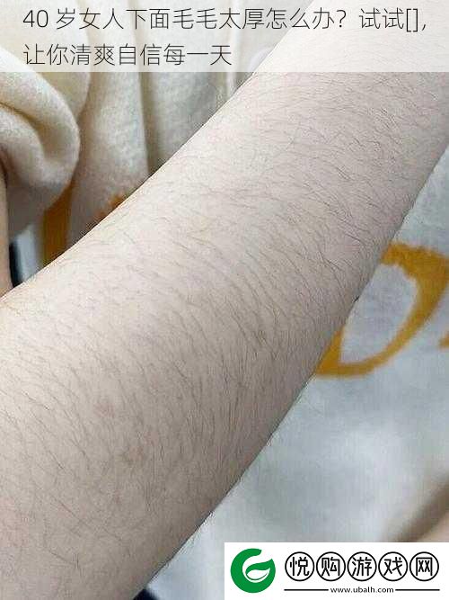 40