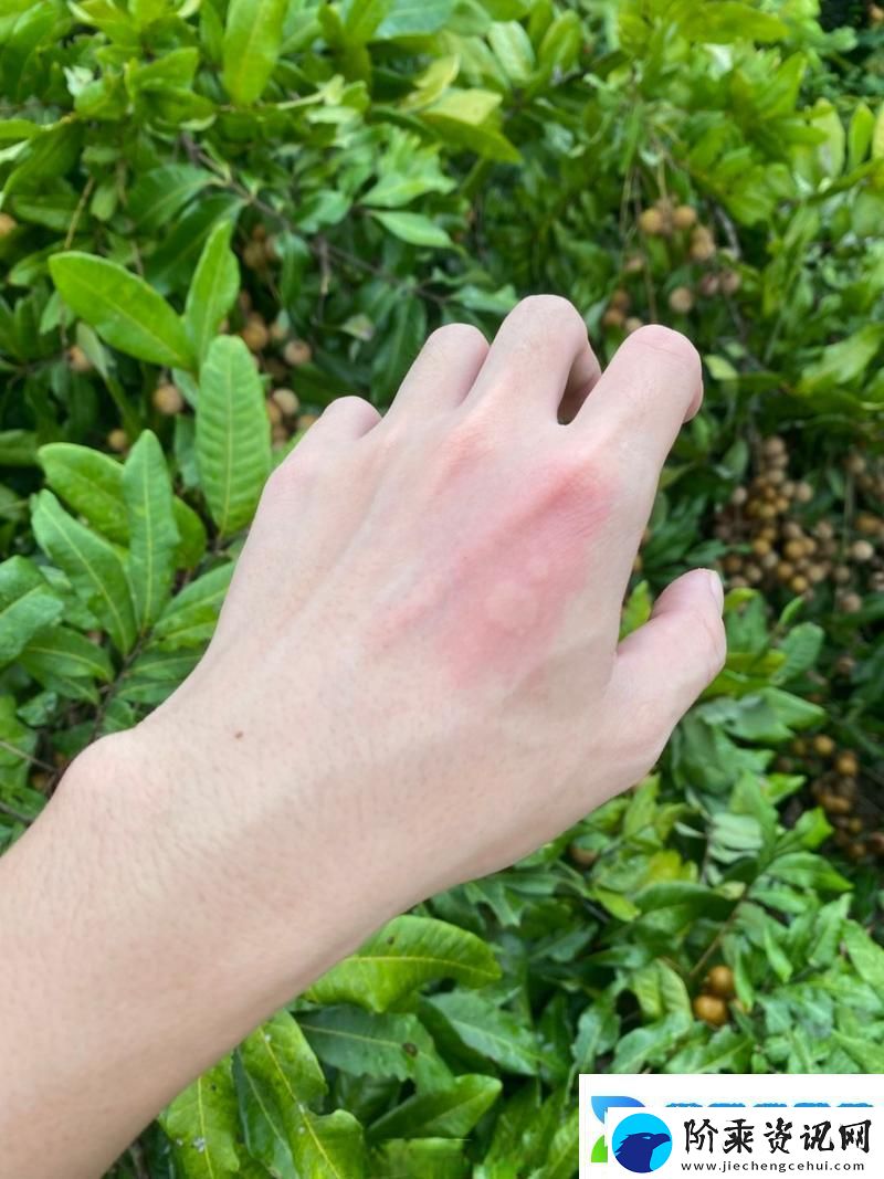一下痛两下麻三下就像蜜蜂爬揭秘网友