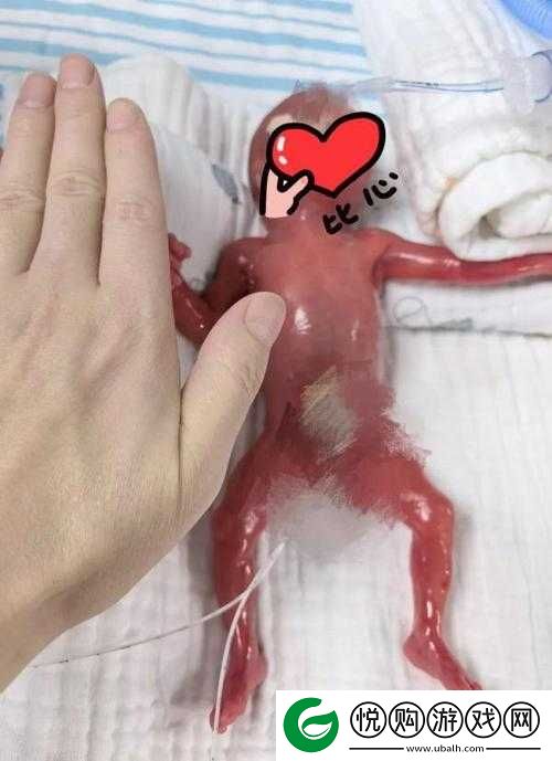早产儿